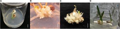 Transcriptomic and <mark class="highlighted">Metabolomic Analyses</mark> Reveals That Exogenous Methyl Jasmonate Regulates Galanthamine Biosynthesis in Lycoris longituba Seedlings